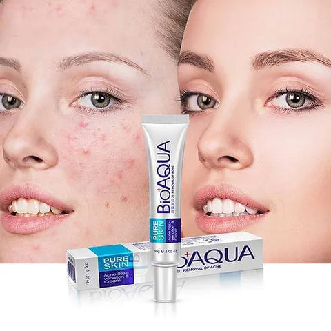 BIOAQUA - KIT COMPLETO ANTI ACNE Hermosa Universo